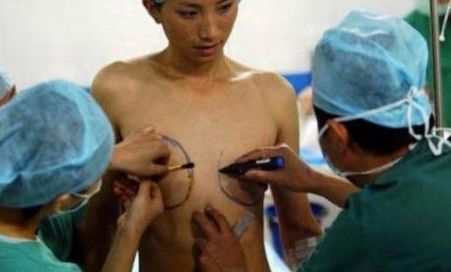 紀實：變性手術全過程 男人如何變成女人