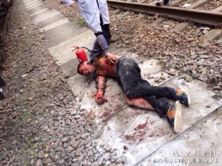 福州東站一男爬上火車頂部觸電 全身大面積燒傷