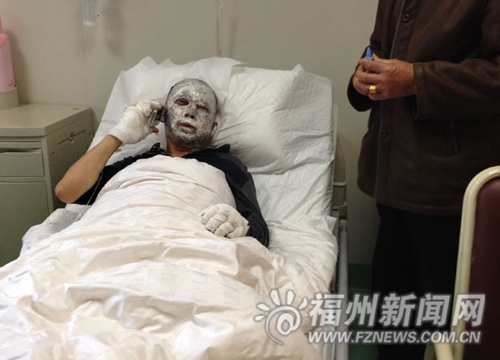 中亭街化糞池爆炸工人被燒傷 疑因煙頭引燃沼氣