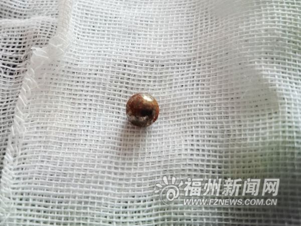 仁德路天降鋼珠嵌進老人后腦勺　民警將加強巡邏