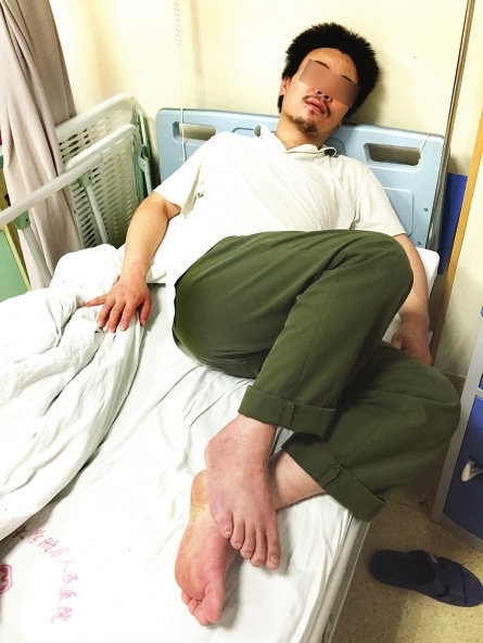 長(zhǎng)樂男子被馬蜂蜇毒蛇咬　靠吃草藥喝溪水爬回家