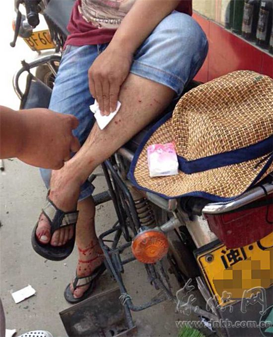 長樂一貨車壓到石塊后爆胎　飛濺玻璃碴劃傷路人