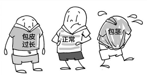包皮問題