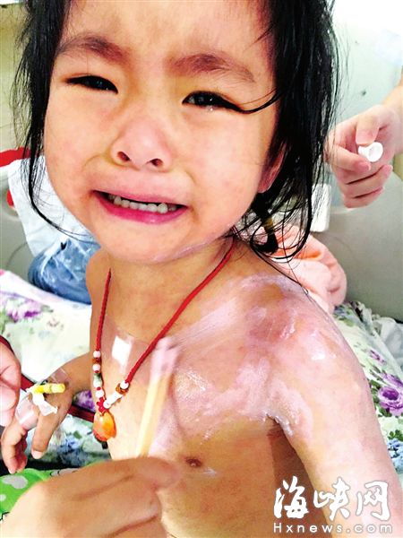 3歲的蘭蘭，全身紅疹，因疼癢難忍而大哭