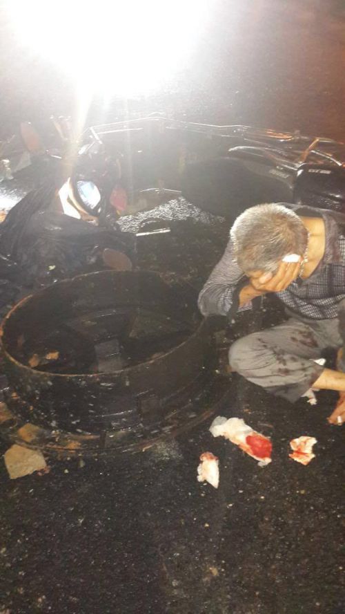 建新南路窨井掀蓋不設(shè)防　騎車依伯沒(méi)躲開(kāi)摔骨折