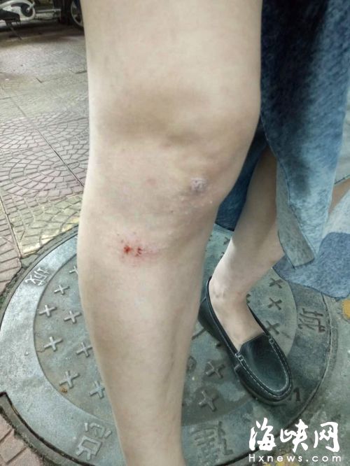 4條惡狗突然躥出，路過的女士被嚇得摔傷膝蓋