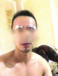 石膏粘住眉毛，取下來時，眉毛也被拔光 