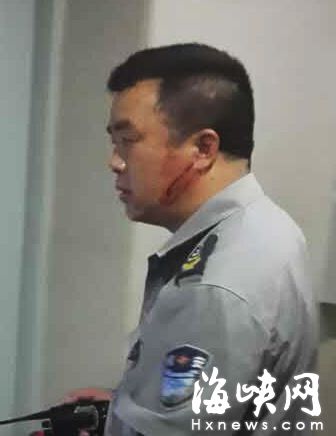 夏運康臉上刀傷八厘米 