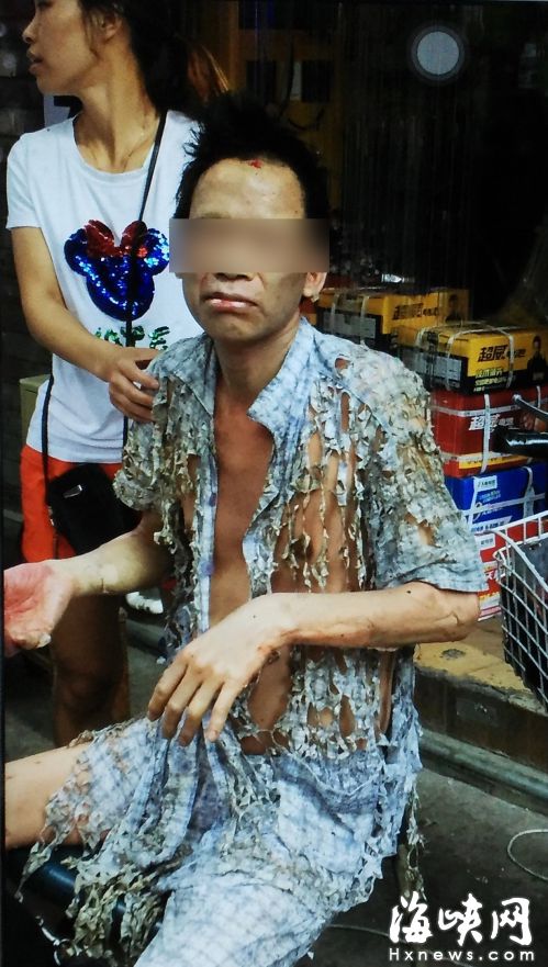 男租戶的衣服被氣浪撕成爛布條